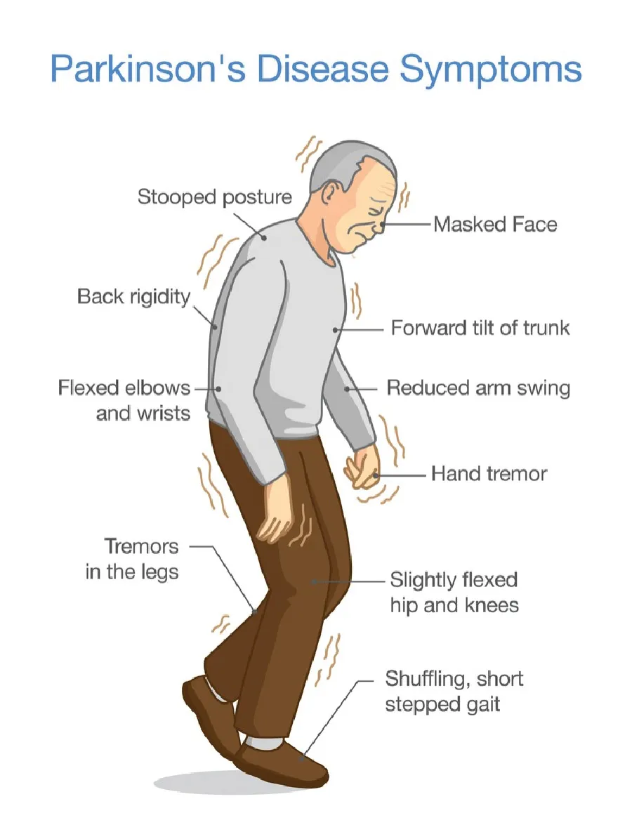 Parkinson's-Disease